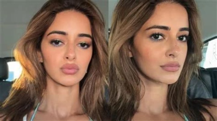 Alanna Panday Plastic Surgery Before And After Photo Business Guide