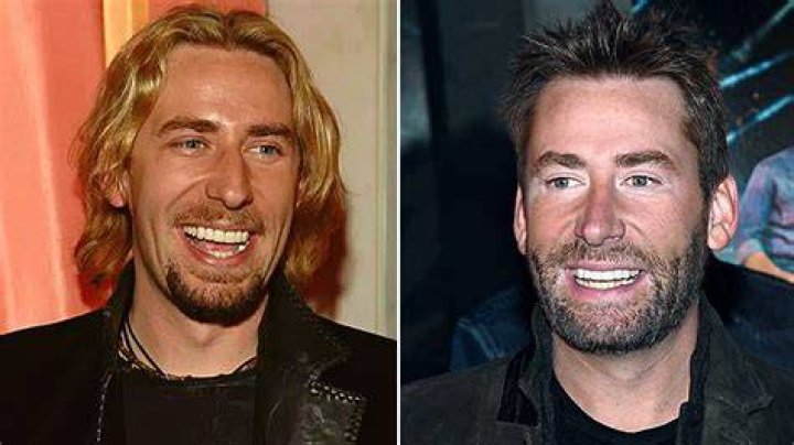 Chad Kroeger Recalls 'Burning the Candle at Both Ends' During