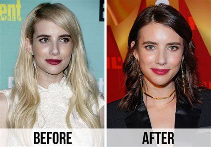 Has Emma Roberts Had Plastic Surgery? BeforeAndAfter Photos Life