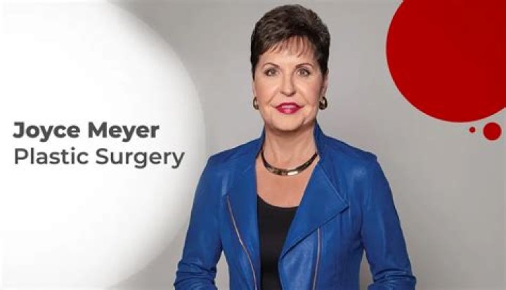 Joyce Meyer's Cosmetic Surgery Transformation: Unveiling The Truth