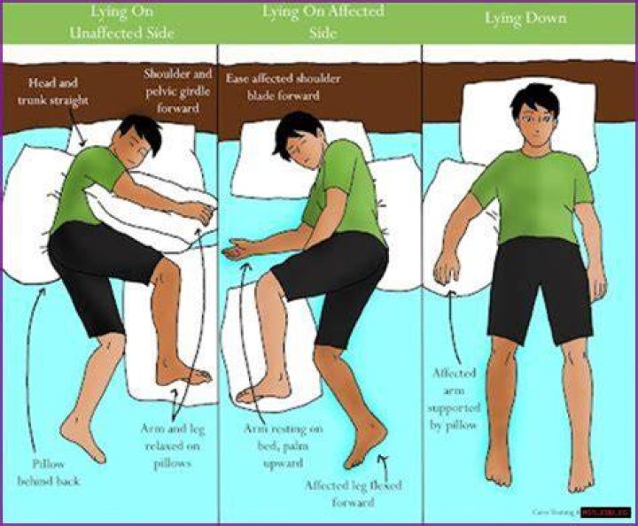 Mastering Left-Sided Hemiparesis: A Comprehensive Guide