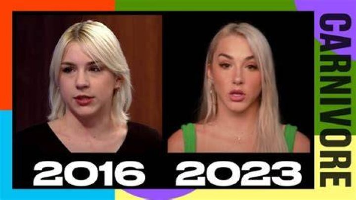 Mikhaila Peterson Plastic Surgery Why Does She Look Unrecognizable?