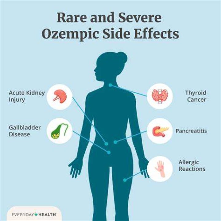 Ozempic side effects and how to avoid them SingleCare