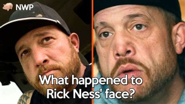 Rick Ness Before And After Photos Neck Surgery Details 2024