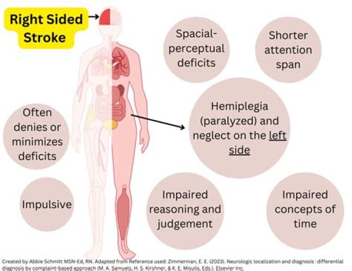 Right-Sided Hemiparesis: Causes, Symptoms, And Treatment