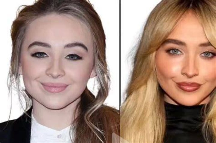 Sabrina Carpenter's Surgery: Has She Gone Under The Knife?