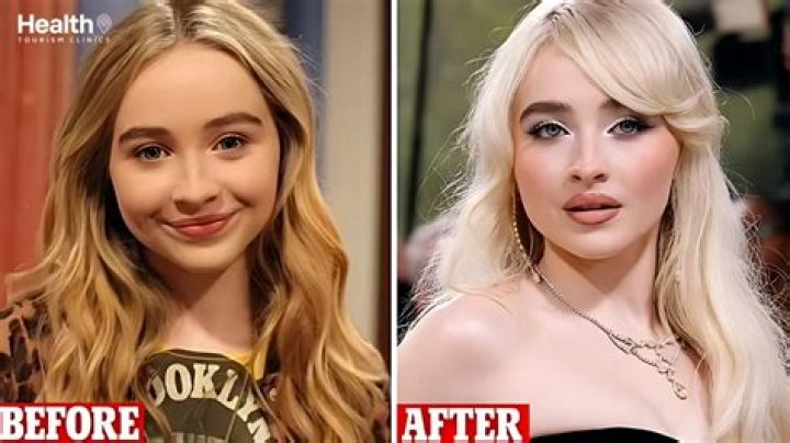 Sabrina Carpenter Plastic Surgery The Secret of Her DollLike Appearance!