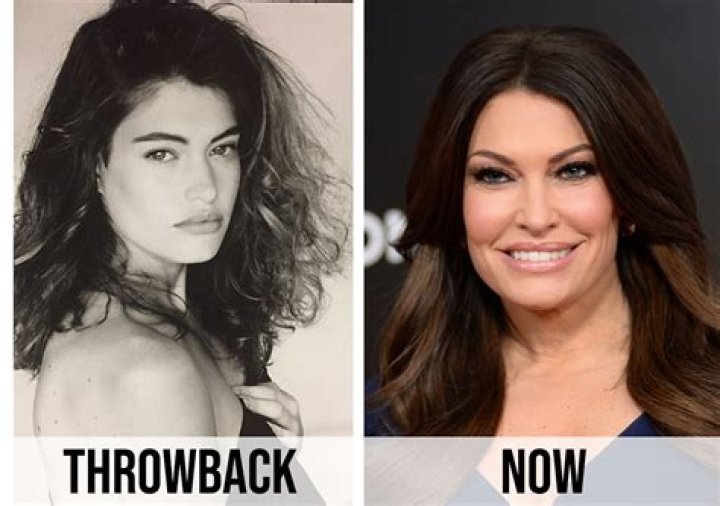 Unveiling The Transformation: Kimberly Guilfoyle Before And After Plastic Surgery