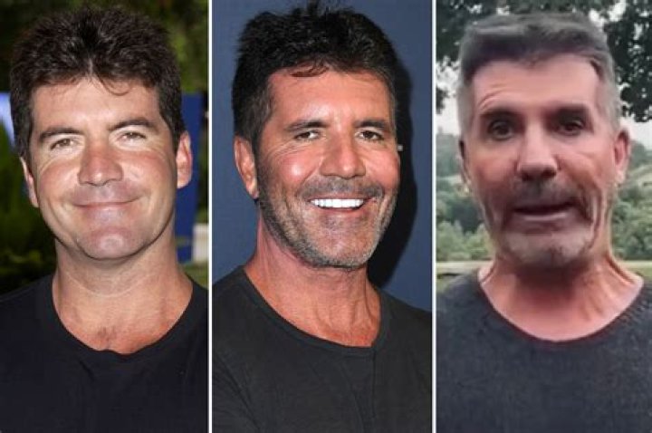 Unveiling The Transformation: Simon Cowell's Pre-Botox Era