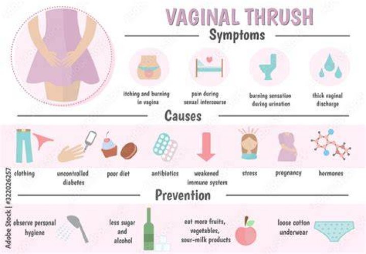 Vetor do Stock Vaginal thrush, candidiasis. Vaginal infection. Causes