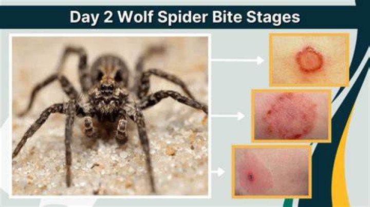 Wolf Spider Bite Symptoms, Treatment, and Pictures.